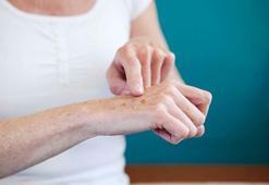 Yaşlanma lekelerine dikkat! Cilt lekeleri nasıl geçer?