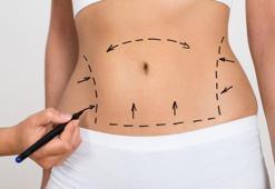 Mezoterapi yöntemi ile mükemmel vücut