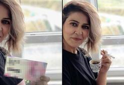 Zayıflama fotoğrafları ilaç firması tarafından izinsiz kullanıldı