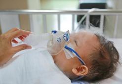 RSV (Respiratuar Sinsityal Virus) nedir? RSV belirtileri nelerdir, nasıl tedavi edilir?