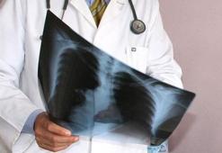 Kadınlar için risk daha fazla! Sigara akciğer kanseri riskini 22 kat arttırıyor