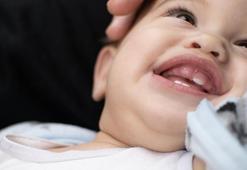 Biberon çürüğü çocukların ana diş gelişimini etkiliyor