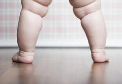 Çocukluk çağı obezitesi yetişkinlik hastalıklarının temelini oluşturuyor