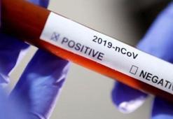 İran koronavirüs teşhis kiti üretmeye başlayacak