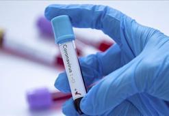 Bakan Varank müjdeyi verdi: Corona virüse karşı yerli ilaç üretildi