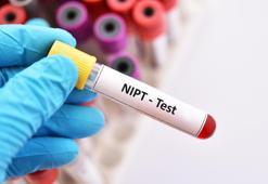 Patau sendromu kısaca nedir? Belirtileri nelerdir? Patau sendromu tekrarlar mı?