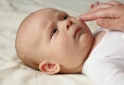 Bebeklerde egzamaya ne iyi gelir? Çocuklarda neden egzama olur? Egzama için tedavi yöntemleri