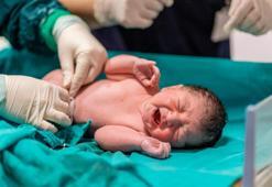 Bebeklerde göbek ve kasık fıtığı neden olur? Belirtileri neler? Çocuklarda göbek fıtığı nasıl geçer?