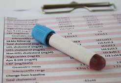 Kan uyuşmazlığıyla ilgili merak edilenler