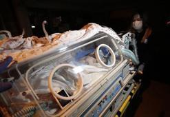 Suriye'de dünyaya gelen siyam ikizleri ambulans uçakla Ankara'ya getirildi