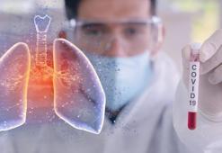 Koah hastaları, kritik Covid-19 hastalarının yüzde 15.7'sini oluşturuyor