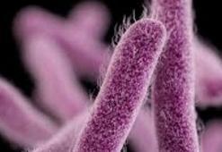 Ebola salgınını keşfeden uzmandan kritik uyarı: KOVİD-19 kadar hızlı yayılabilecek