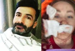 Eşinin yüzünü falçatayla kesen adam hala öldürmekle tehdit ediyor