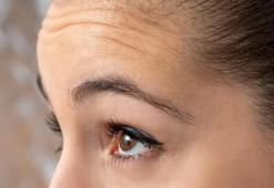İleri yaşta en sık görme kaybı nedeni: Sarı nokta