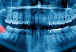 Yer tutucu kullananlar dikkat!