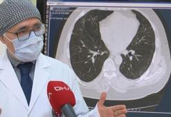 Son dakika... Cerrahpaşa Dekanı açıkladı: Yüzde 30 artış var...