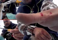 Antalya'da zehirli balık dehşeti! 'Kolda çürümeye neden oluyor...'