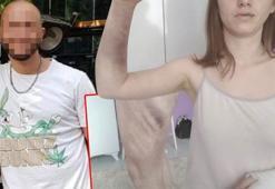 İzmir’de dehşet! Berk Öcalan isimli şahıs sevgilisini vahşice darp etti…