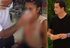 Survivor Merve Aydın'ın sağlık durumu hakkında Acun Ilıcalı'dan açıklama