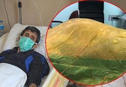 Karnındaki 'saatli bomba' 4 yıl içinde büyüdü! Doktorlar bile inanamadı