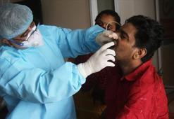 Korkulan oldu! Kara mantar hastalığı bir ülkeye daha sıçradı