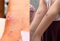 İstanbullulara kabusu yaşatıyorlar! Sivrisinek salgını hakkında uzmanlardan açıklama