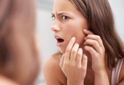 Sivilcelerden hızlı bir şekilde kurtulmanın 3 yolu