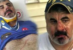 Son dakika: Ankara'da vazife malulü engelliye dayak!