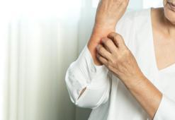 Mantar hastalığı nedir?