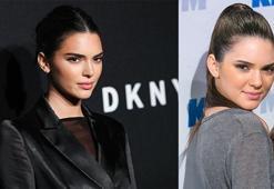 Kendall Jenner'ın bugüne kadar yaptırdığı 10 estetik operasyon