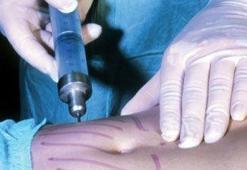 Şekle girmenin kolay yolu