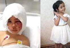 Pitbull saldırısına uğrayan Asiye yeniden ameliyat oldu! Asiye'nin son durumu hakkında açıklama