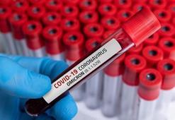 Yeni karantina süresi ne kadar? Omicron'da pozitif ve temaslı olanların karantina süreleri