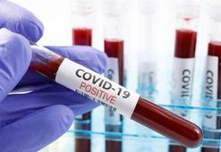 Bu ilk olabilir! Covid-19 testleri pozitif çıktı