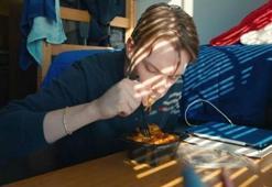 Arkadaşının bıraktığı yemeği yedi, bacaklarından oldu