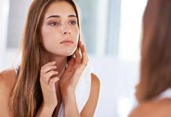 Ciltteki kahverengi lekeler nasıl geçer?