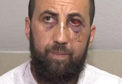 Türk aileye Alman polisinden öldüresiye dayak