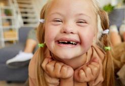 Down sendromu hastalık değil genetik bir farklılıktır