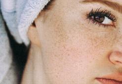 Güneş lekelerini yok ediyor, kırışıklığı önlüyor!
