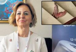 Profesörü 'dana dili' ile tehdit ettiler! 'Bu bir cinayet girişimi'