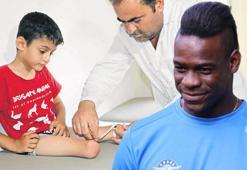 Bekle beni Balotelli! Küçük Muhammed protezine kavuşuyor