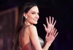 Türkiye'de trend diş estetiği: Hollywood gülüşü!