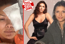 Tuğba Altıntop'a köpek saldırdı! 'Sokak hayvanları toplatılsın' kampanyası ikiye böldü