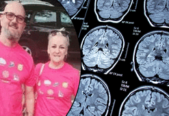 Korkunç hastalığını merdivenlerden düşünce fark etti