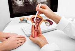 Endometrium nedir, ne işe yarar? Endometrial kanser belirtileri nelerdir?