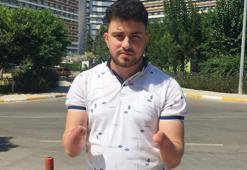 Annesinin hamileyken yaptığı nedeniyle elleri olmadan doğdu!