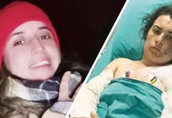 Elti terörü! 17 kez bıçaklayıp üzerine kaynar su döktü