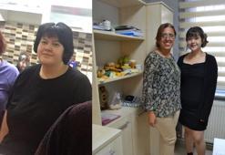 Ameliyat olmadan 50 kilo vermeyi başardı!