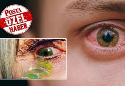 Sosyal medyada viral oldu, resmen tehlike saçıyor! Bir anda kör olabilirsiniz