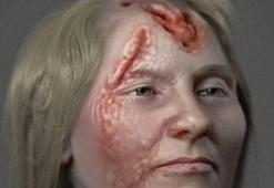 Cinsel hastalık kafatasını deldi! Böyle canlandırdılar